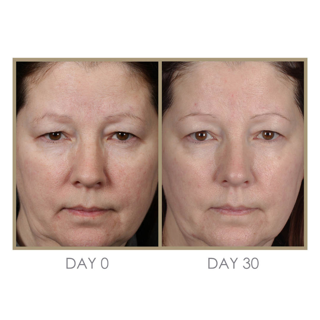 Dream Cream Moisturizing Treatment