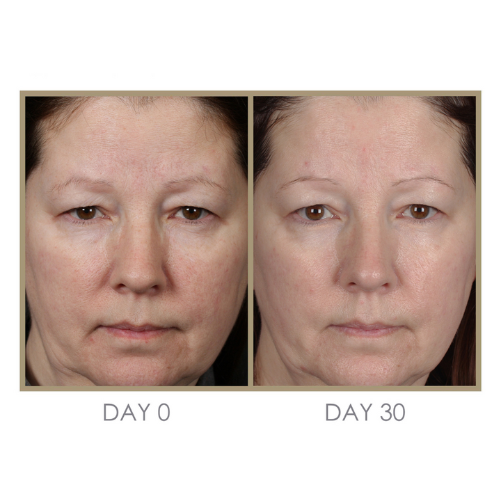 Dream Cream Moisturizing Treatment