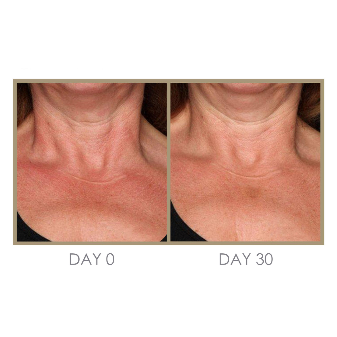 Dream Cream Moisturizing Treatment